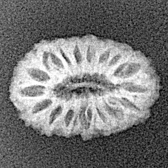 17 Mukhi Rudraksha 16.7mm 0.86gm - Xray