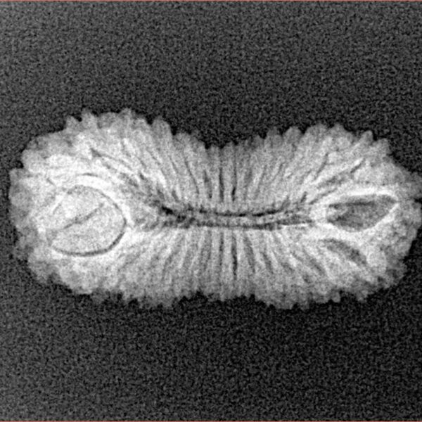 30 Mukhi Rudraksha 25mm 1.85gm - Xray