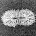 25 Mukhi Rudraksha 21.1mm 0.93gm - Xray