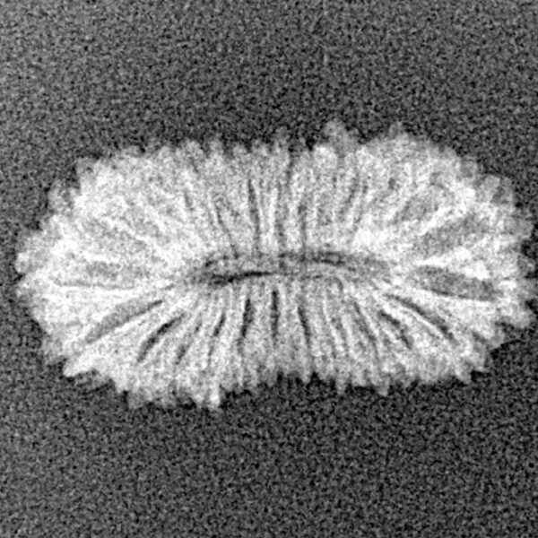 25 Mukhi Rudraksha 21.1mm 0.93gm - Xray