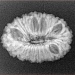 19 Mukhi Rudraksha 24.6mm 2.5gm - Xray