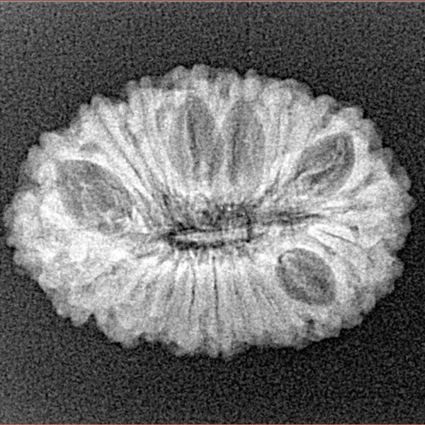 19 Mukhi Rudraksha 24.6mm 2.5gm - Xray