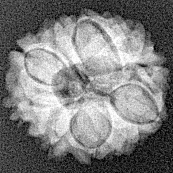 12 Mukhi Rudraksha 17.4mm 1.77gm - Xray