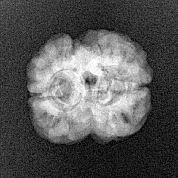 2 Mukhi Rudraksha 21.3mm 2.27gm - Xray