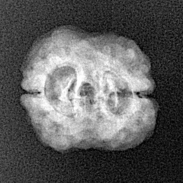 2 Mukhi Rudraksha 21.7mm 1.84gm - Xray