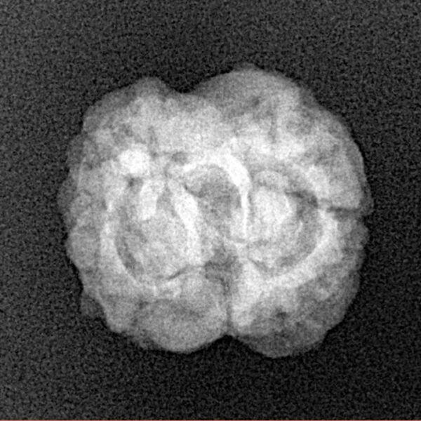 2 Mukhi Rudraksha 21.7mm 2.29gm - Xray