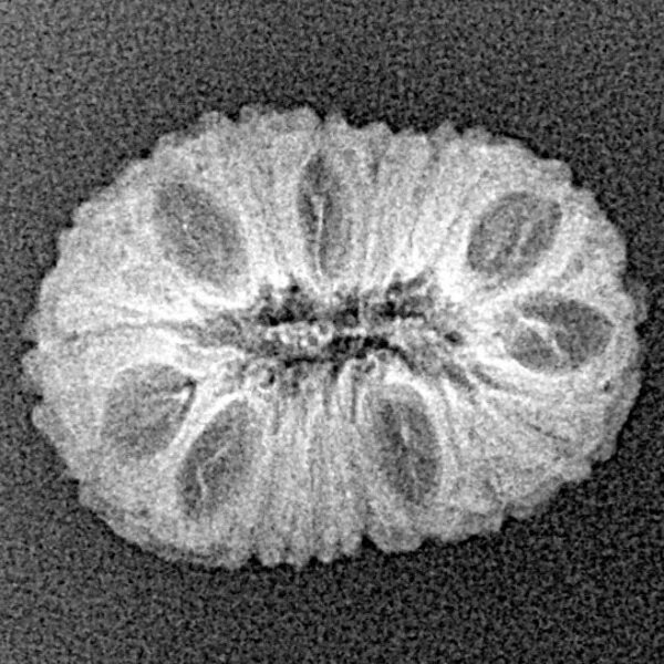 16 Mukhi Rudraksha 20mm 1.3gm - Xray