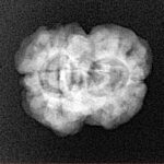 2 Mukhi Rudraksha 23.5mm 2.45gm - Xray