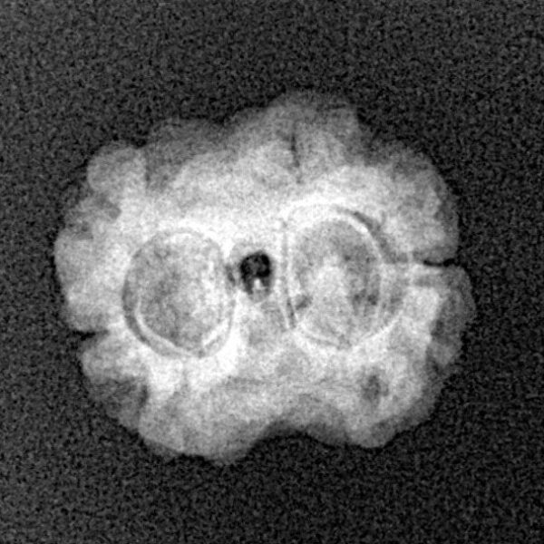 2 Mukhi Rudraksha 19.7mm 1.58gm - Xray