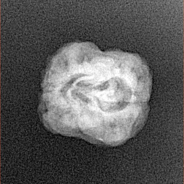 2 Mukhi Rudraksha 21.5mm 1.9gm - Xray