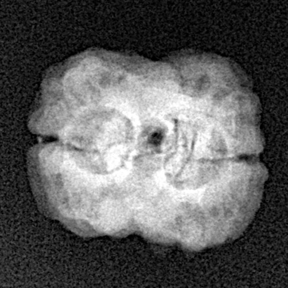 2 Mukhi Rudraksha 25.4mm 2gm - Xray