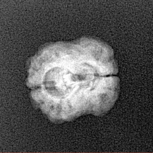 2 Mukhi Rudraksha 21.3mm 1.5gm - Xray