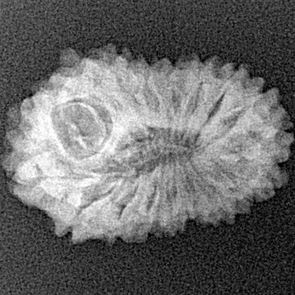 18 Mukhi Rudraksha 22.9mm 2.09gm - Xray