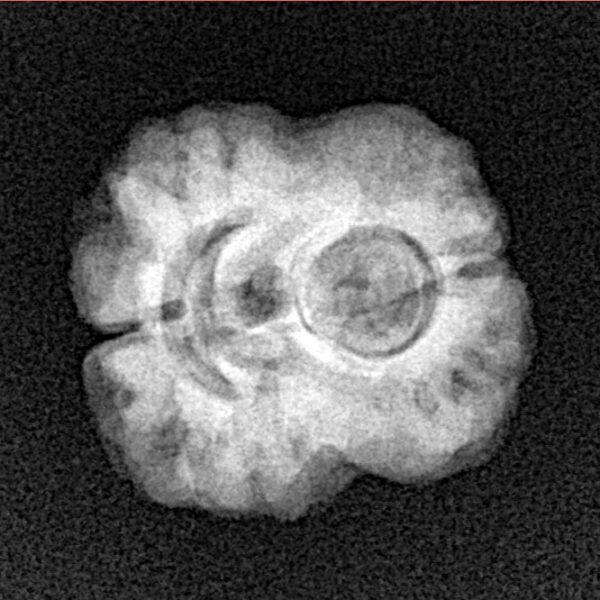 2 Mukhi Rudraksha 24mm 2.55gm - Xray