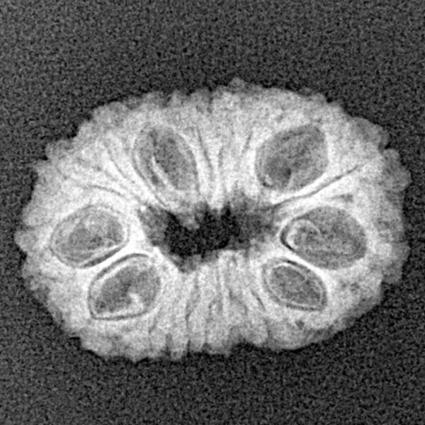 17 Mukhi Rudraksha 20mm 1.67gm - Xray