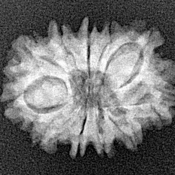 11 Mukhi Rudraksha 21.9mm 2.29gm - Xray