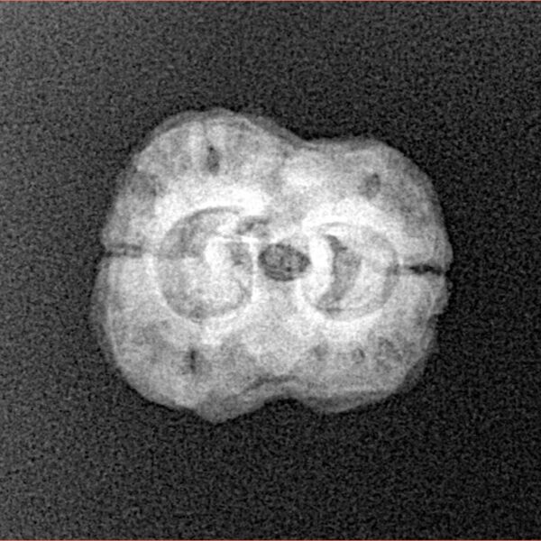 2 Mukhi Rudraksha 22mm 2.25gm - Xray