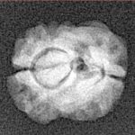2 Mukhi Rudraksha 15.4mm 1.11gm - Xray