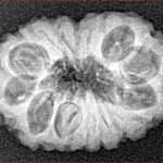 16 Mukhi Rudraksha 20.5mm 2.06gm - Xray