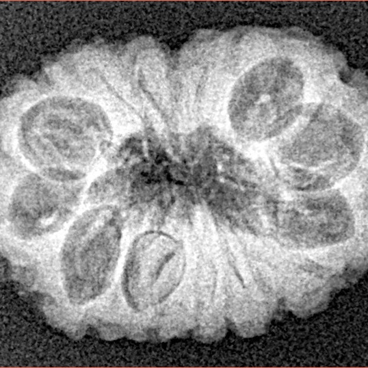 16 Mukhi Rudraksha 20.5mm 2.06gm - Xray