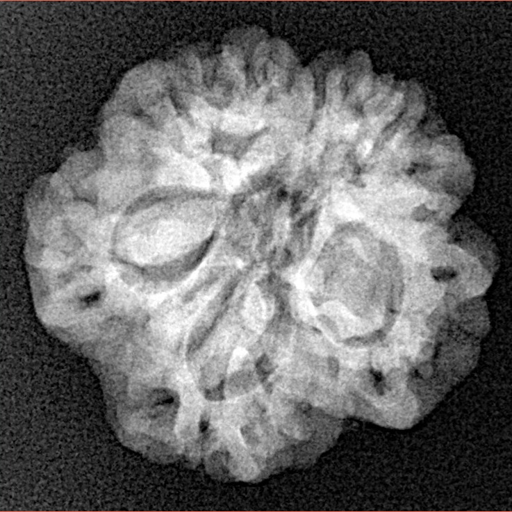 1MK(Underdeveloped) 22.1mm 3.22gm - Xray