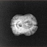 2 Mukhi Rudraksha 20.2mm 1.62gm - Xray