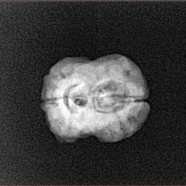 2 Mukhi Rudraksha 20.2mm 1.62gm - Xray