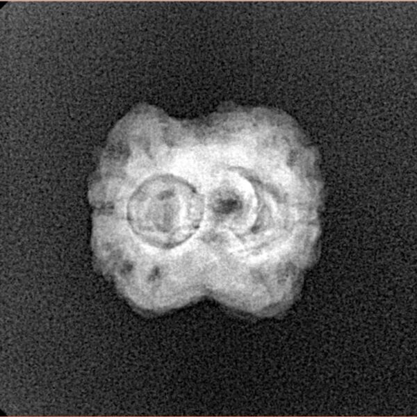 2 Mukhi Rudraksha 21.2mm 1.8gm - Xray