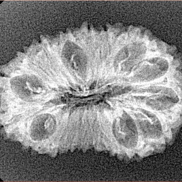 19 Mukhi Rudraksha 28.1mm 2.37gm - Xray