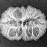 18 Mukhi Rudraksha 24.1mm 2.74gm - Xray