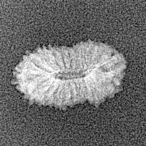 21 Mukhi Rudraksha 14.8mm 0.42gm - Xray