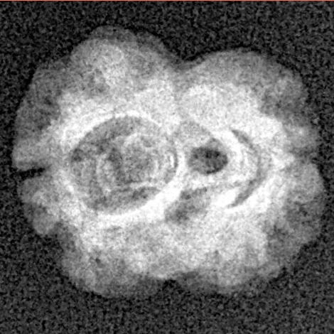 2 Mukhi Rudraksha 17.7mm 1.29gm - Xray