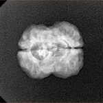 2 Mukhi Rudraksha 20.4mm 2gm - Xray