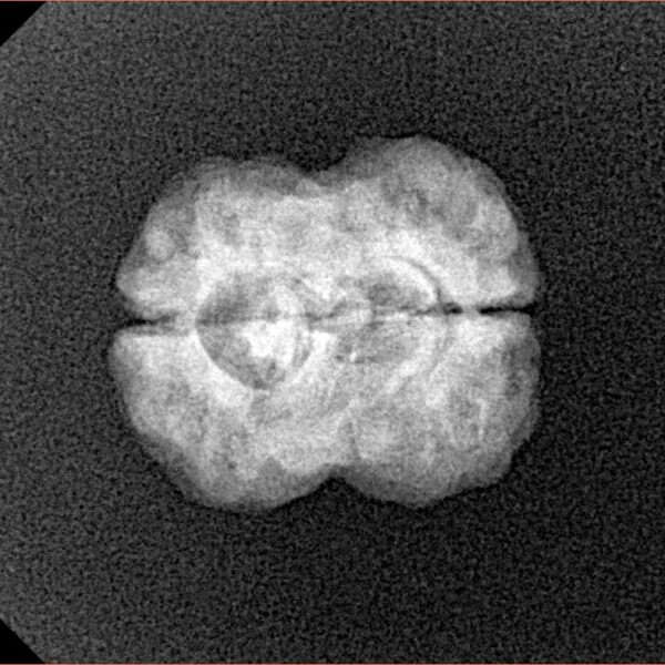 2 Mukhi Rudraksha 20.4mm 2gm - Xray