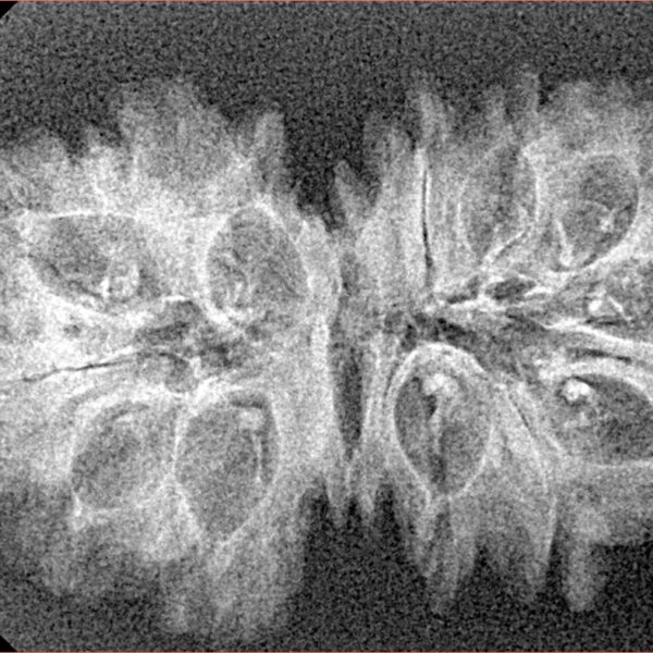 15 Mukhi Gaurishankar 34mm 2.88gm - Xray