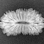 18 Mukhi Rudraksha 20.6mm 1.37gm - Xray