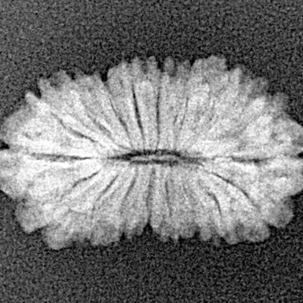 18 Mukhi Rudraksha 20.6mm 1.37gm - Xray