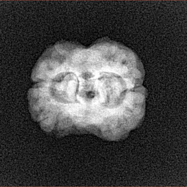 2 Mukhi Rudraksha 25.5mm 2.3gm - Xray