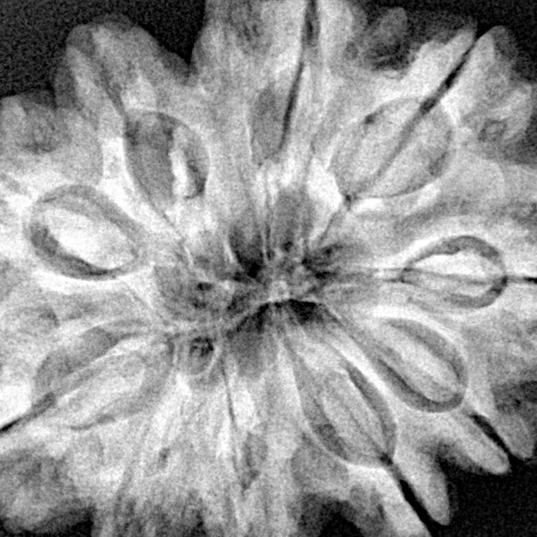 10 Mukhi Rudraksha 32.1mm 8gm - Xray