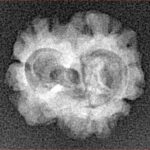2 Mukhi Rudraksha 17.5mm 1.33gm - Xray