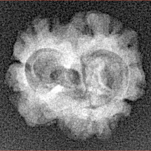 2 Mukhi Rudraksha 17.5mm 1.33gm - Xray