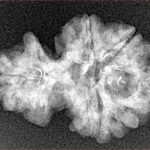 Sawar/Ganesh (4+1) 24mm 2.64gm - Xray