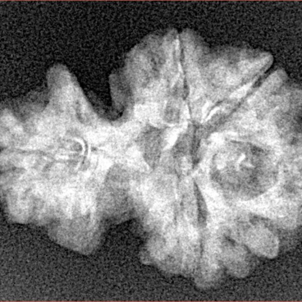 Sawar/Ganesh (4+1) 24mm 2.64gm - Xray