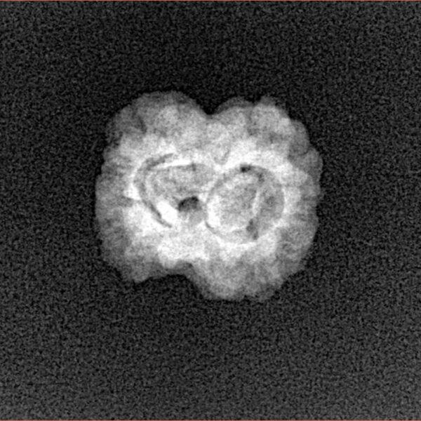 2 Mukhi Rudraksha 19.7mm 1.4gm - Xray