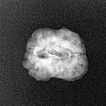 2 Mukhi Rudraksha 19mm 1.26gm - Xray