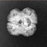 2 Mukhi Rudraksha 18.1mm 1.91gm - Xray