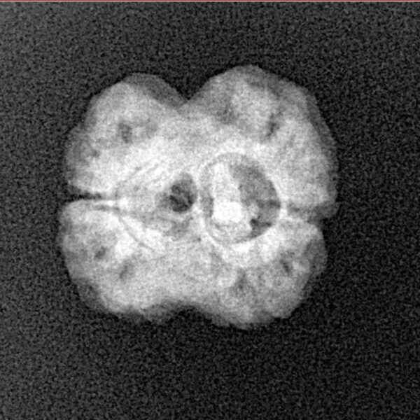 2 Mukhi Rudraksha 18.1mm 1.91gm - Xray