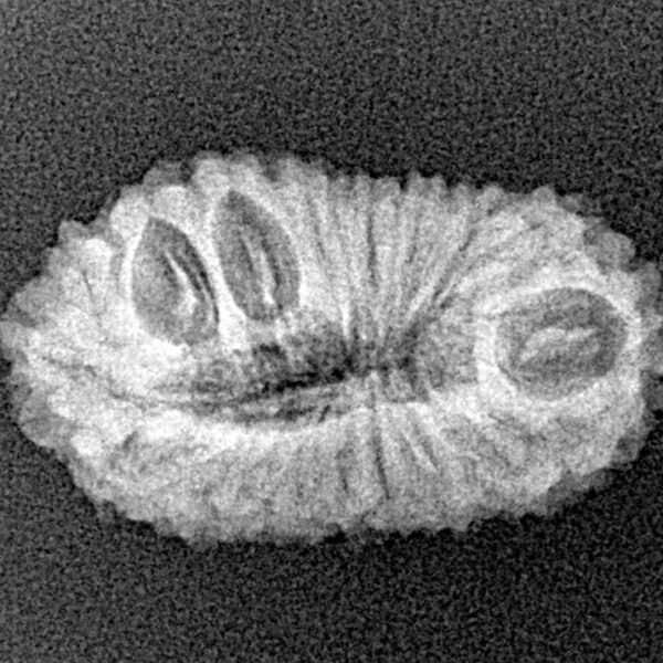 18 Mukhi Rudraksha 23.9mm 1.82gm - Xray