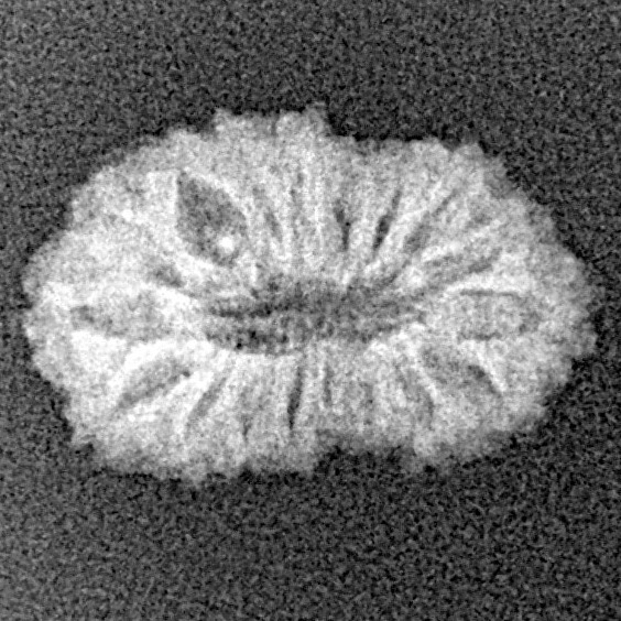 17 Mukhi Rudraksha 17.5mm 0.95gm - Xray