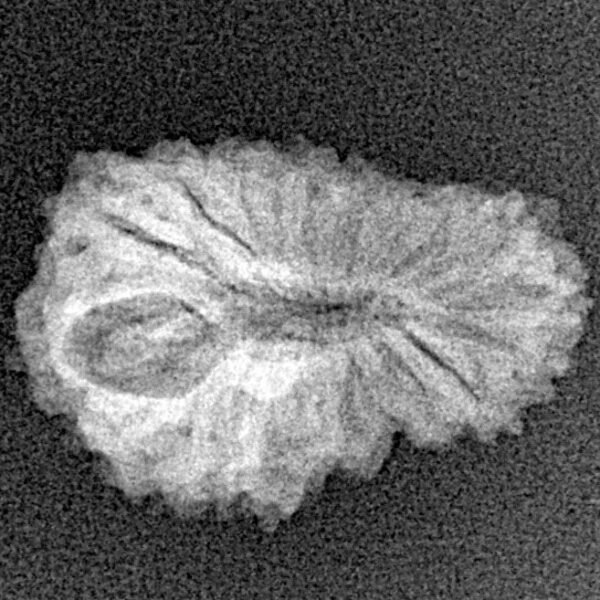 18 Mukhi Rudraksha 21mm 1.52gm - Xray